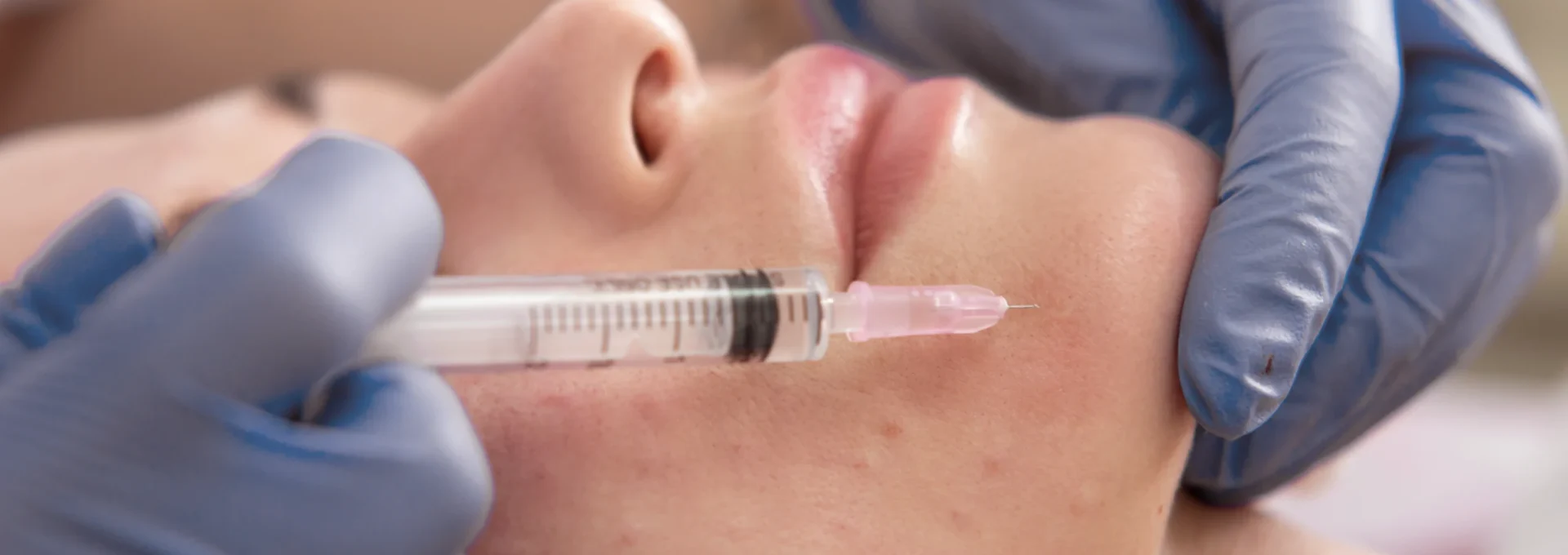 Mesotherapy_facial Mesotherapy_facial