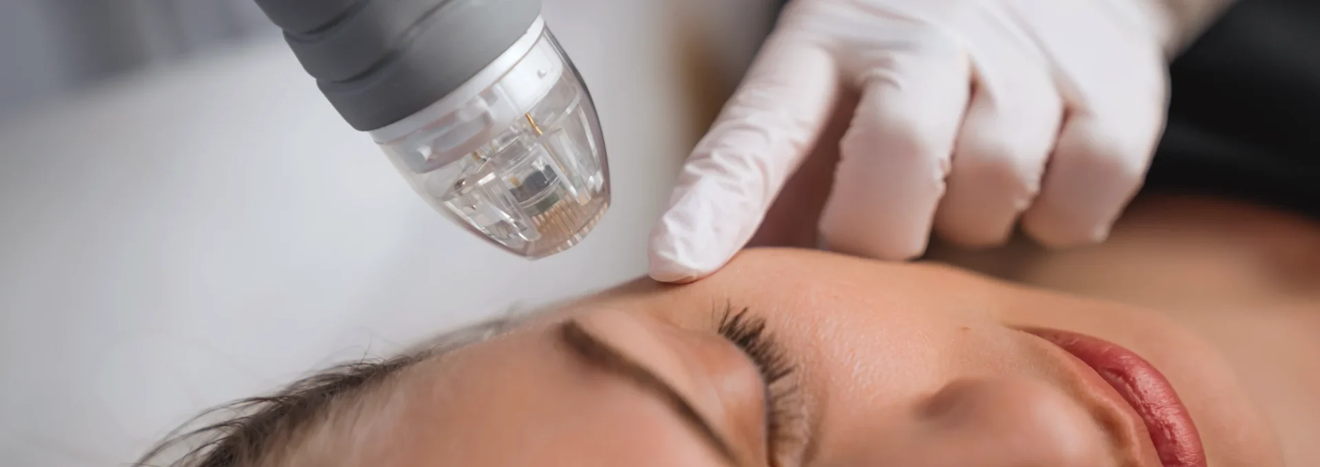 RFMN_facial RFMN_facial